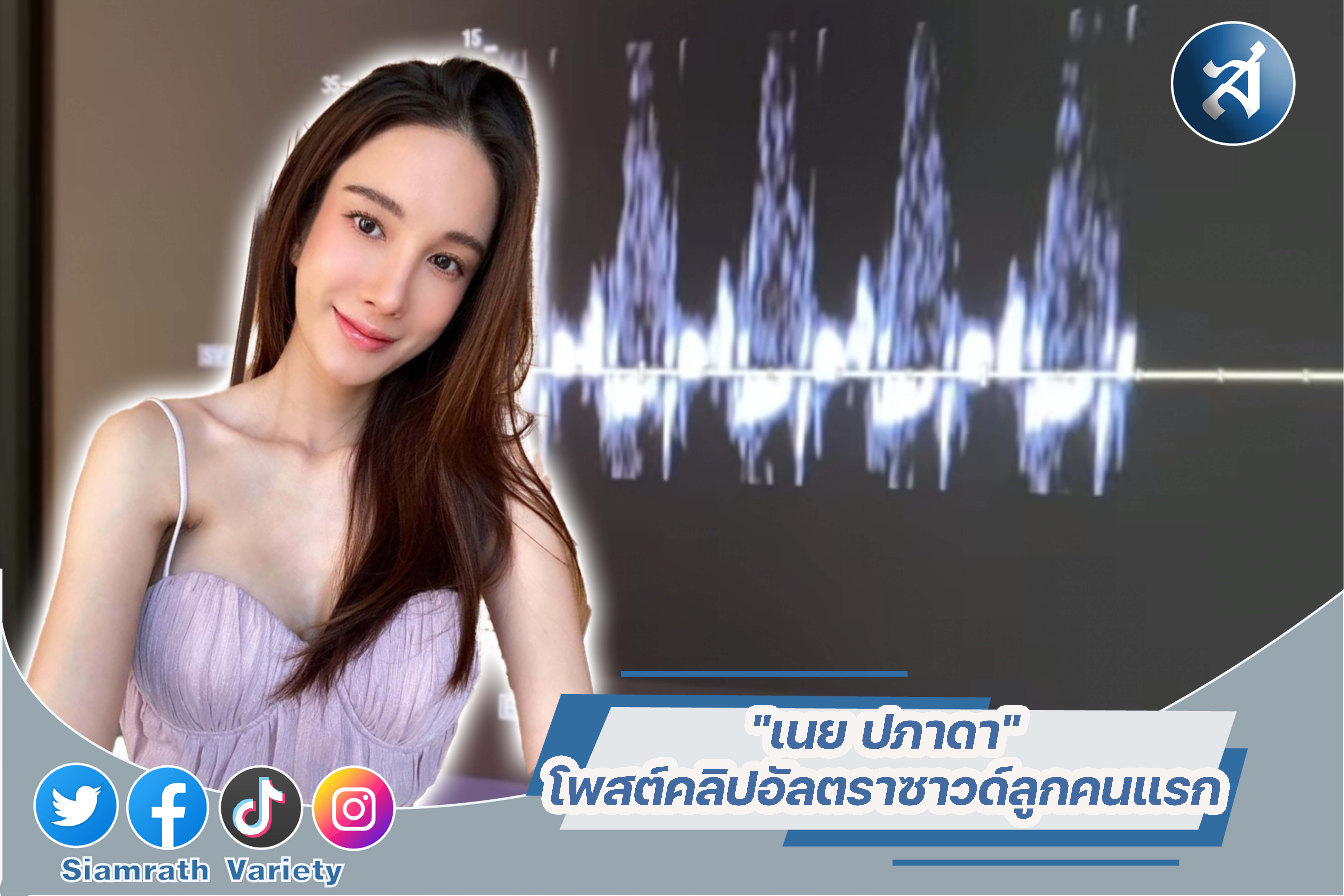 กรอบข่าวเทมเพลต3-01