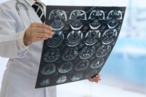 Doctor,Check,Up,X-ray,Film,Of,The,Brain,By,Ct