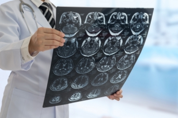 Doctor,Check,Up,X-ray,Film,Of,The,Brain,By,Ct