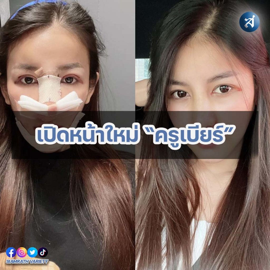 กรอบไอจี2