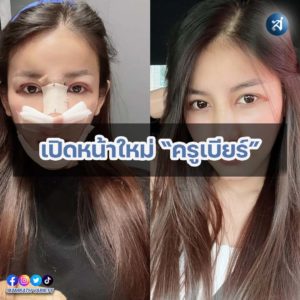 กรอบไอจี2