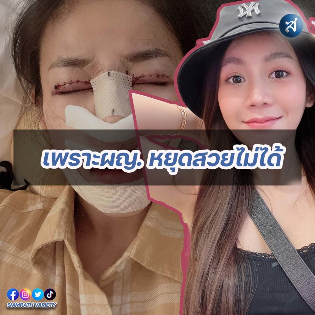 กรอบไอจี2-Recovered-Recovered