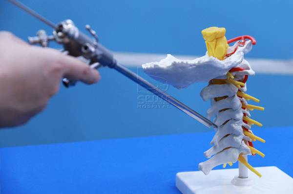 เทคนิค PSCD รักษาโรคกระดูกคอเสื่อม ทางเลือกใหม่ของคนกลัวการผ่าตัด ...