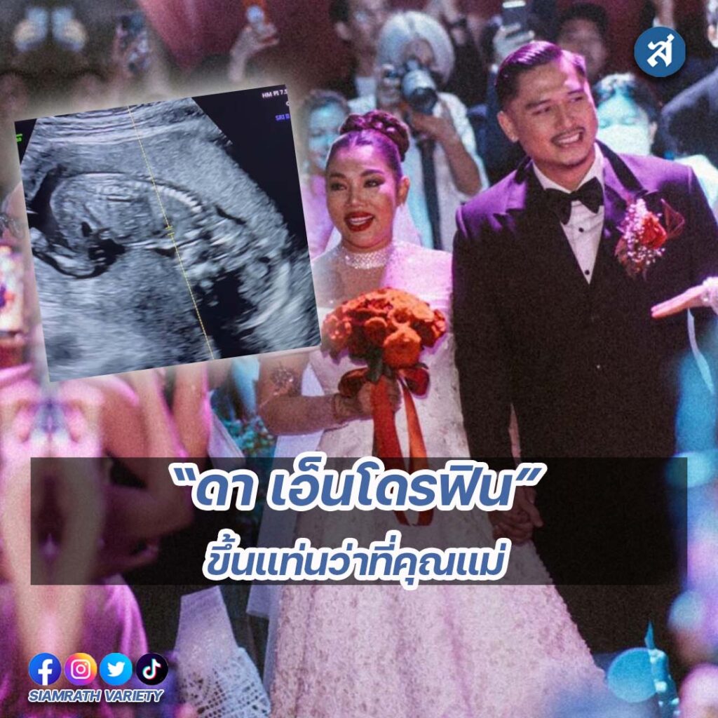 ig2-3-Recovered-Recovered-Recovered-Recovered-Recovered-Recovered-Recovered-Recovered-Recovered-Recovered