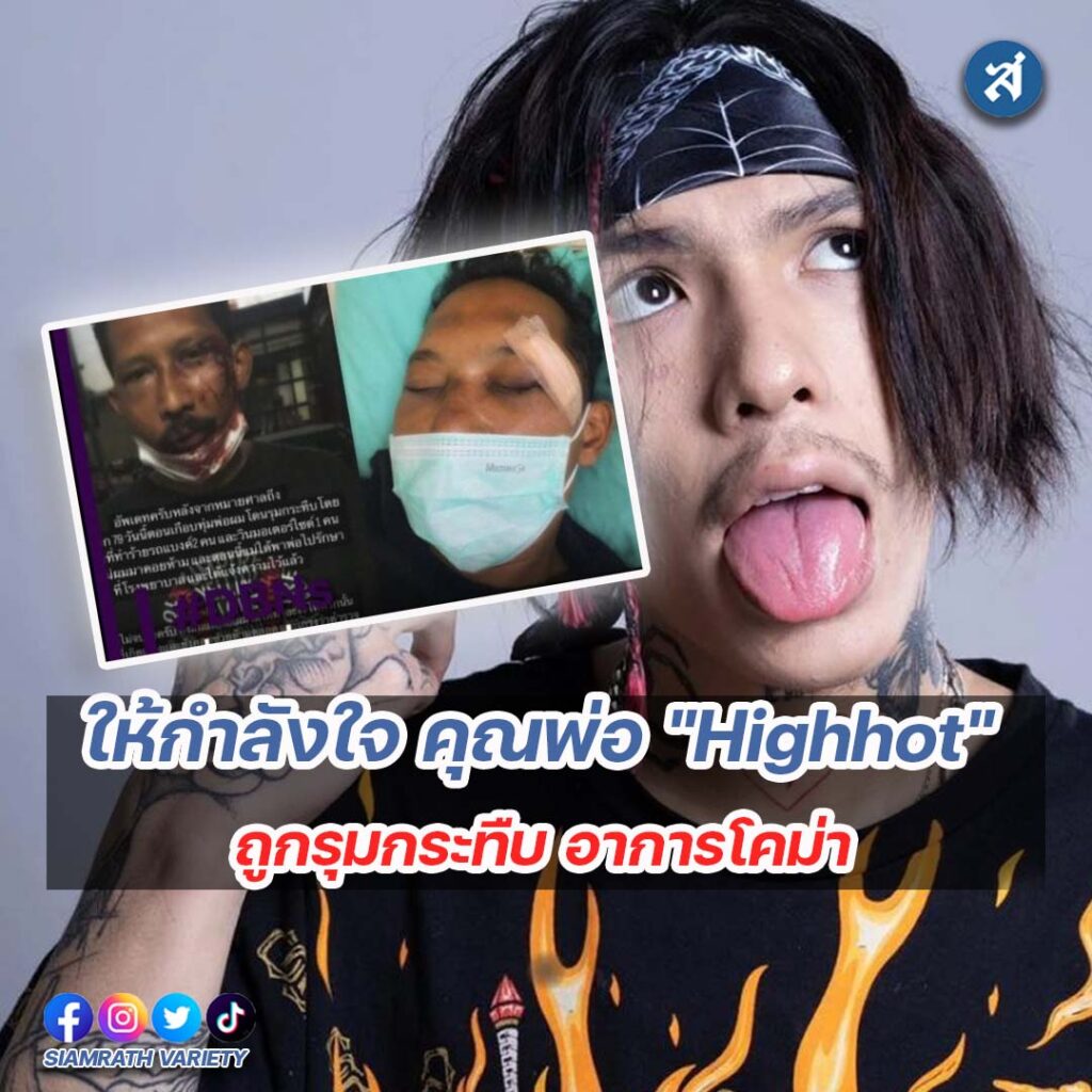 ig2-3-Recovered-Recovered-Recovered-Recovered-Recovered-Recovered-Recovered-Recovered-Recovered-Recovered-Recovered