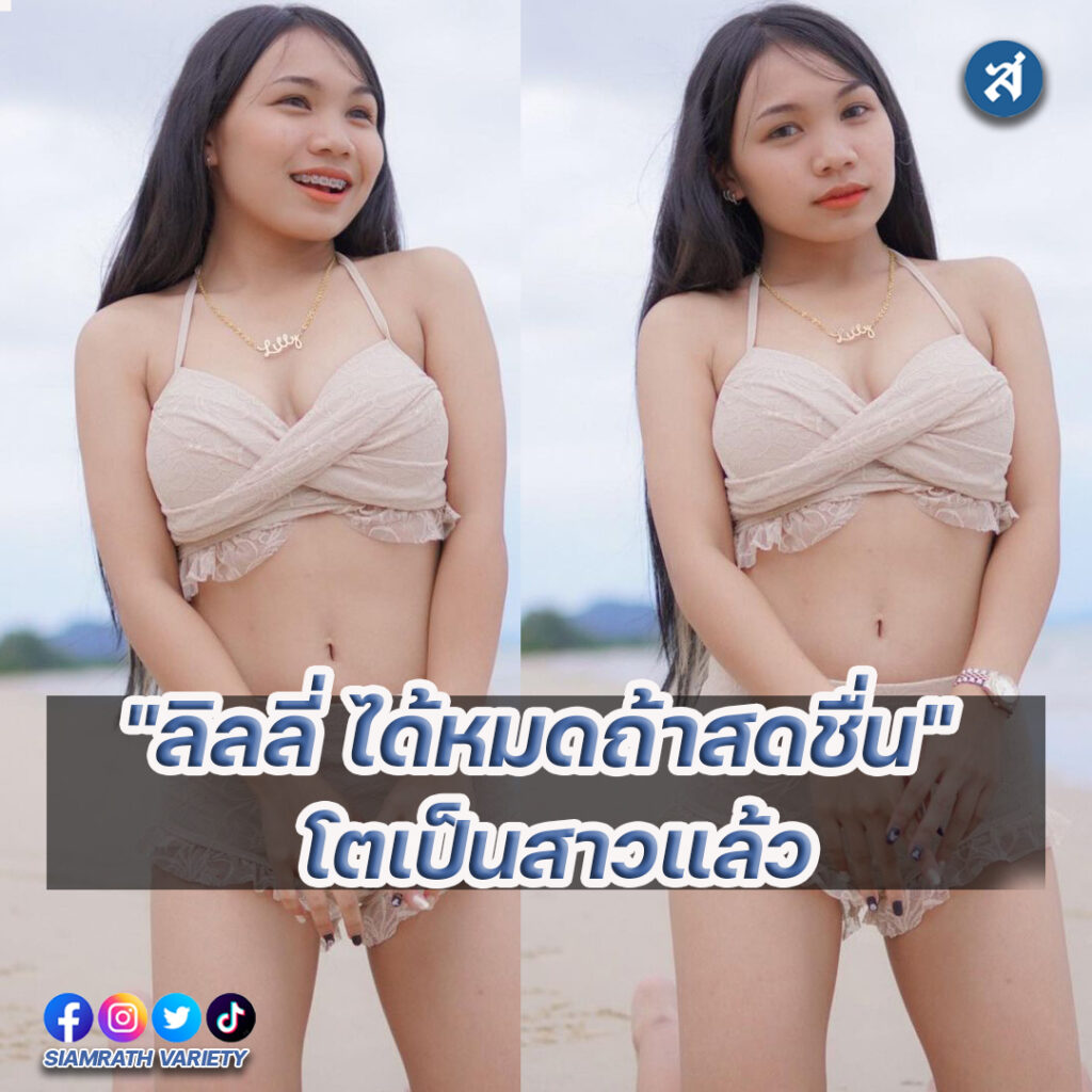 forrexd-Reco24788vered-Recovered-Recovered-Recovered-Recovered-Recovered-Recovered-Recovered-Recovered-Recovered-Recovered-Recovered