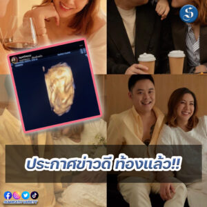 8สนยนาig (32)