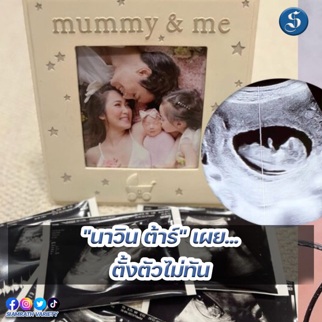 8สนยนาig (83)