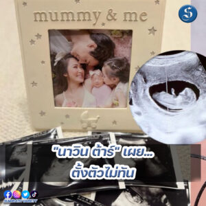 8สนยนาig (83)