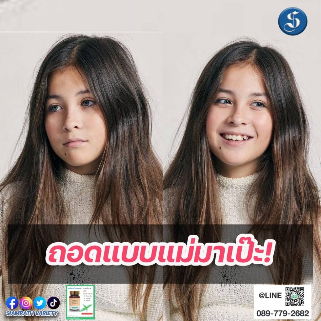 น้องไลลา