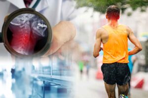 02_หมอนรองกระดูกคอเสื่อม_0