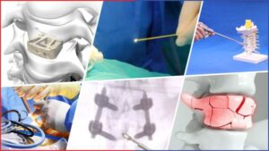 batch_02_6 หัตถการ_0