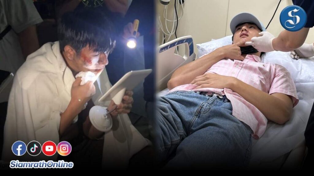 มอสหลง ประสบอุบัติเหตุขณะถ่ายทำภาพยนตร์ ปก