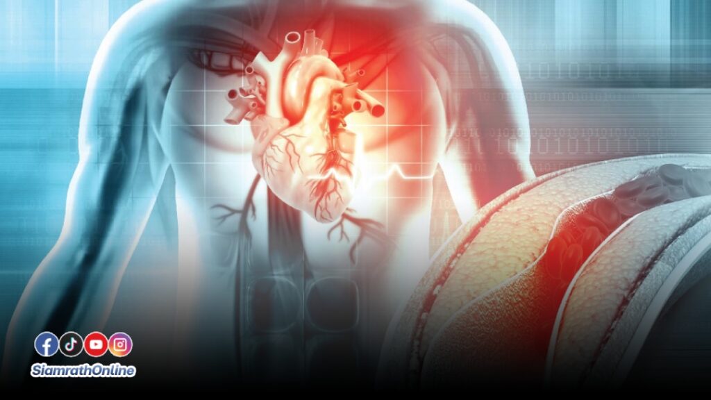 หลอดเลือดหัวใจอุดตัน